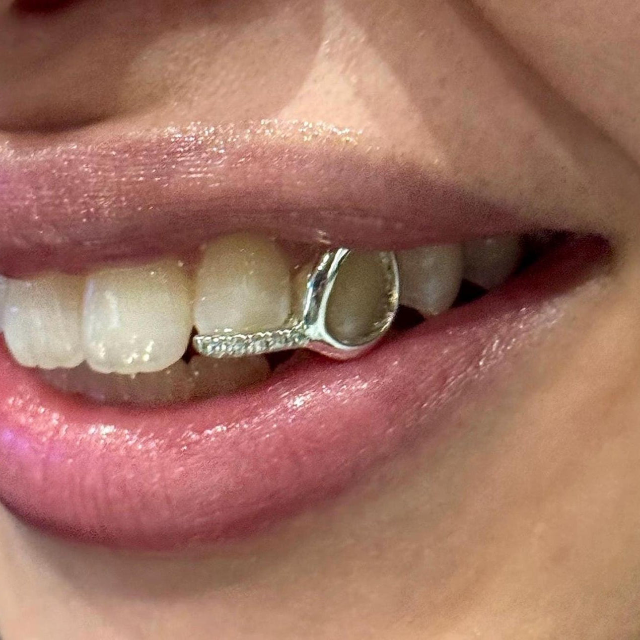 Custom Diamond Tip Window Grillz