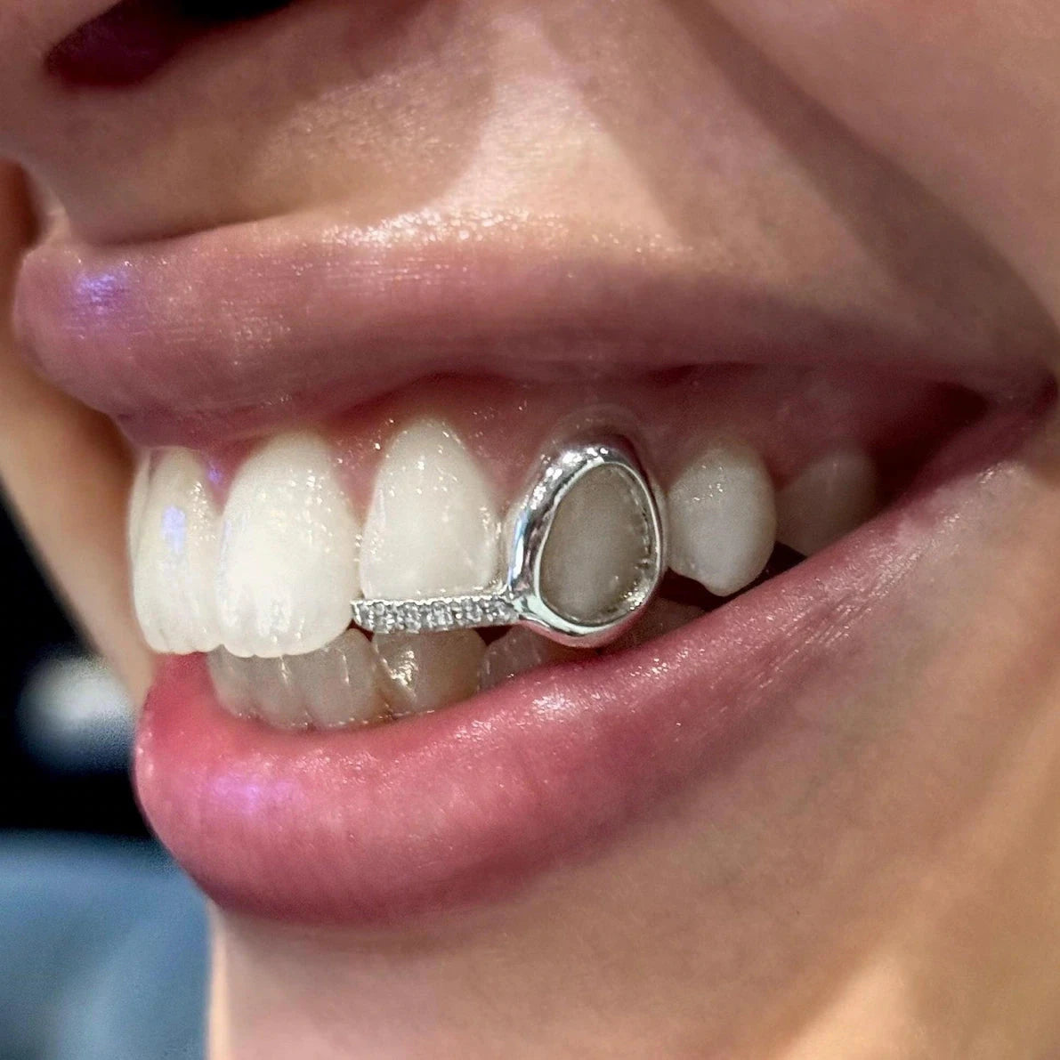 Custom Diamond Tip Window Grillz
