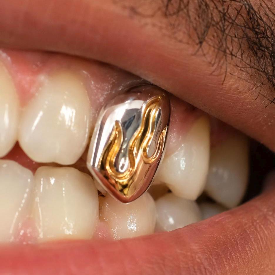 Gold Flame Grillz! *K9 RECOMMENDED*
