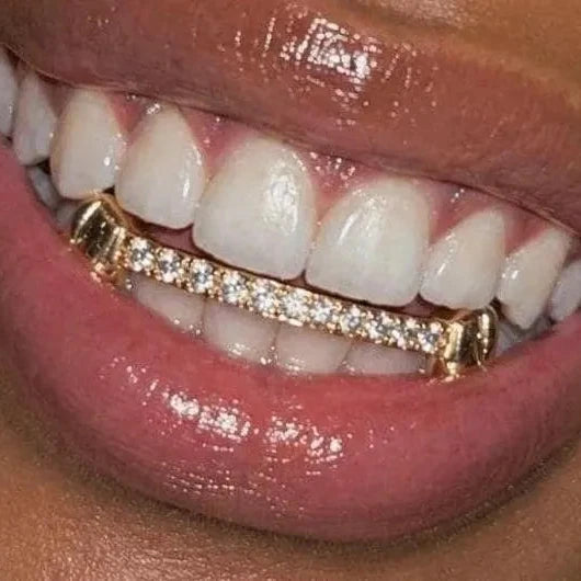 Custom Iced Bar Grillz