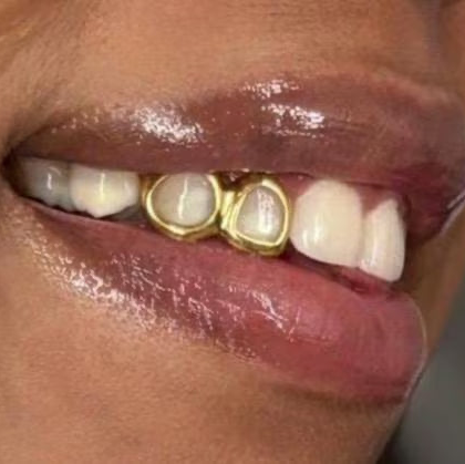 Custom Double Window Grillz