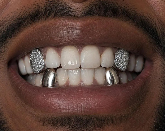 Custom Iced Top & Bottom K9’s Set MOISSANITE Diamonds
