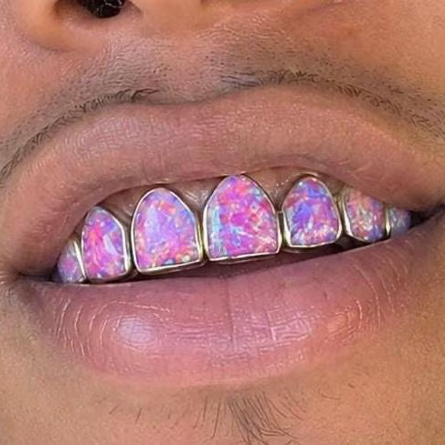 Full Set Purple Opal Grillz, Mulitple Colours Available!
