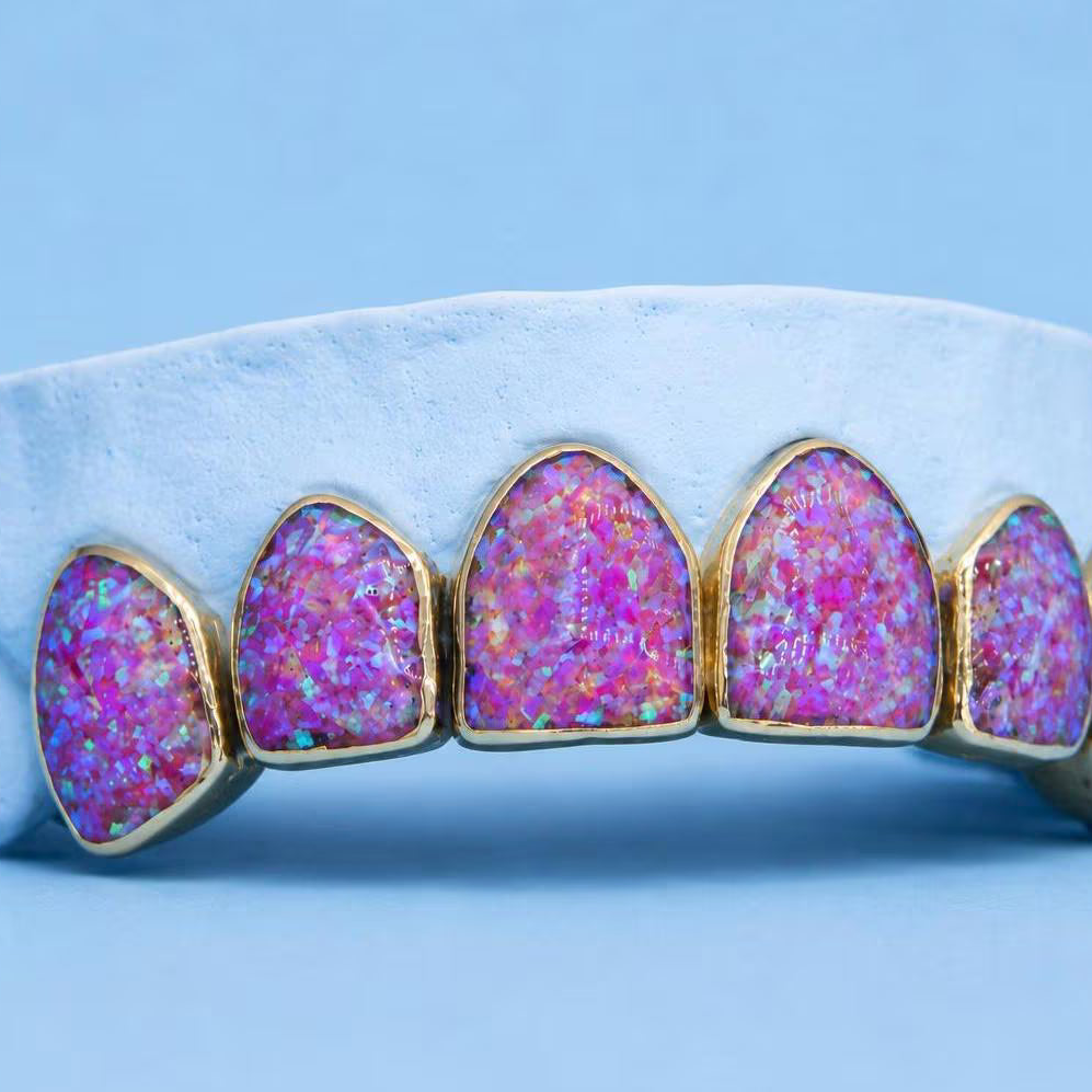Full Set Purple Opal Grillz, Mulitple Colours Available!